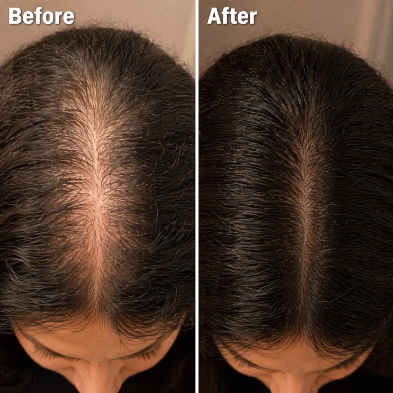 Heaven Smile Royal Hair Therapy Box